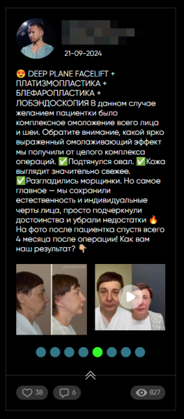 44labs: Посты из ВК